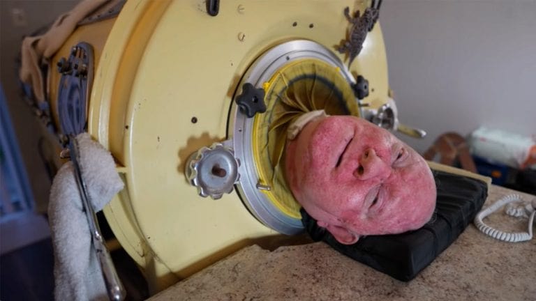 One of the last persons with an iron lung is a 76-year-old guy paralyzed by polio at age 6 and still says, “My life is amazing.”