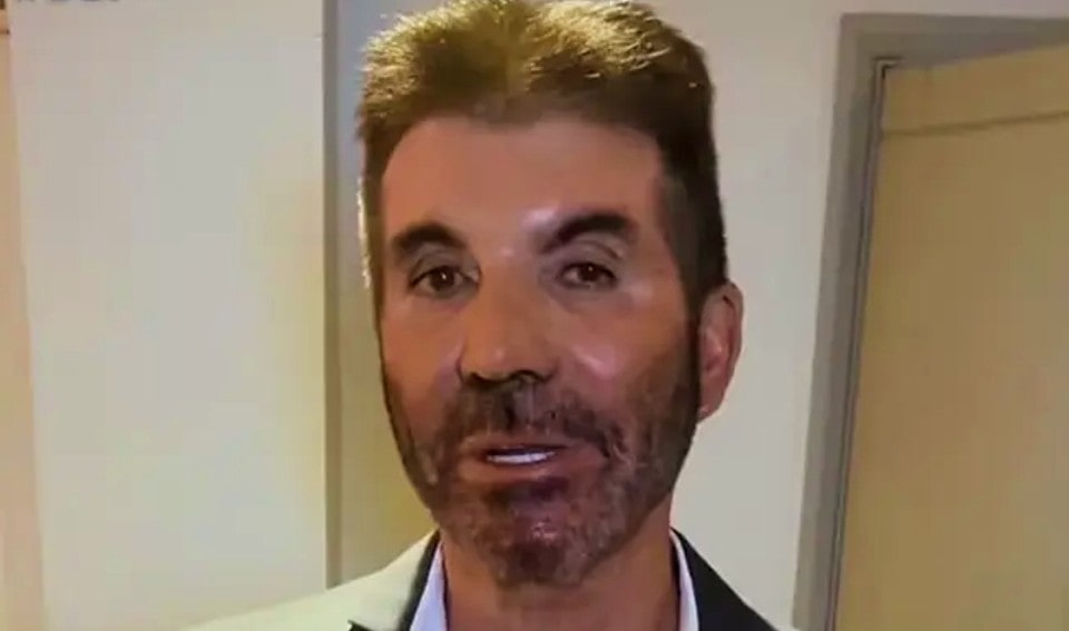 Fans were alarmed by Simon Cowell’s most recent appearance.