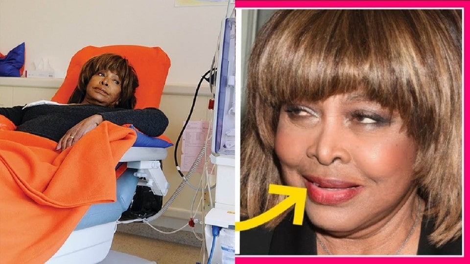 What Tina Turner is going through