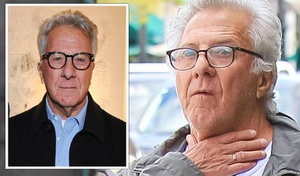 Dustin Hoffman’s throat cancer has fans in tears