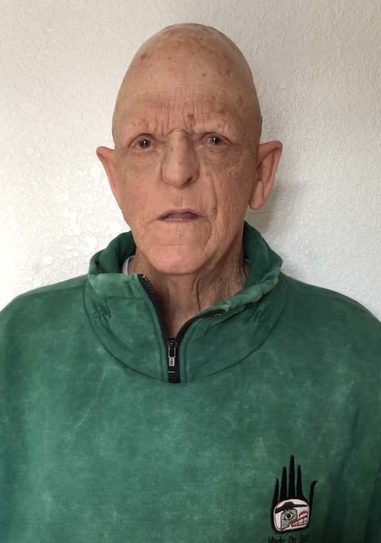 Michael Berryman became an actor despite his rare congenital disability – now he’s an inspiration for millions