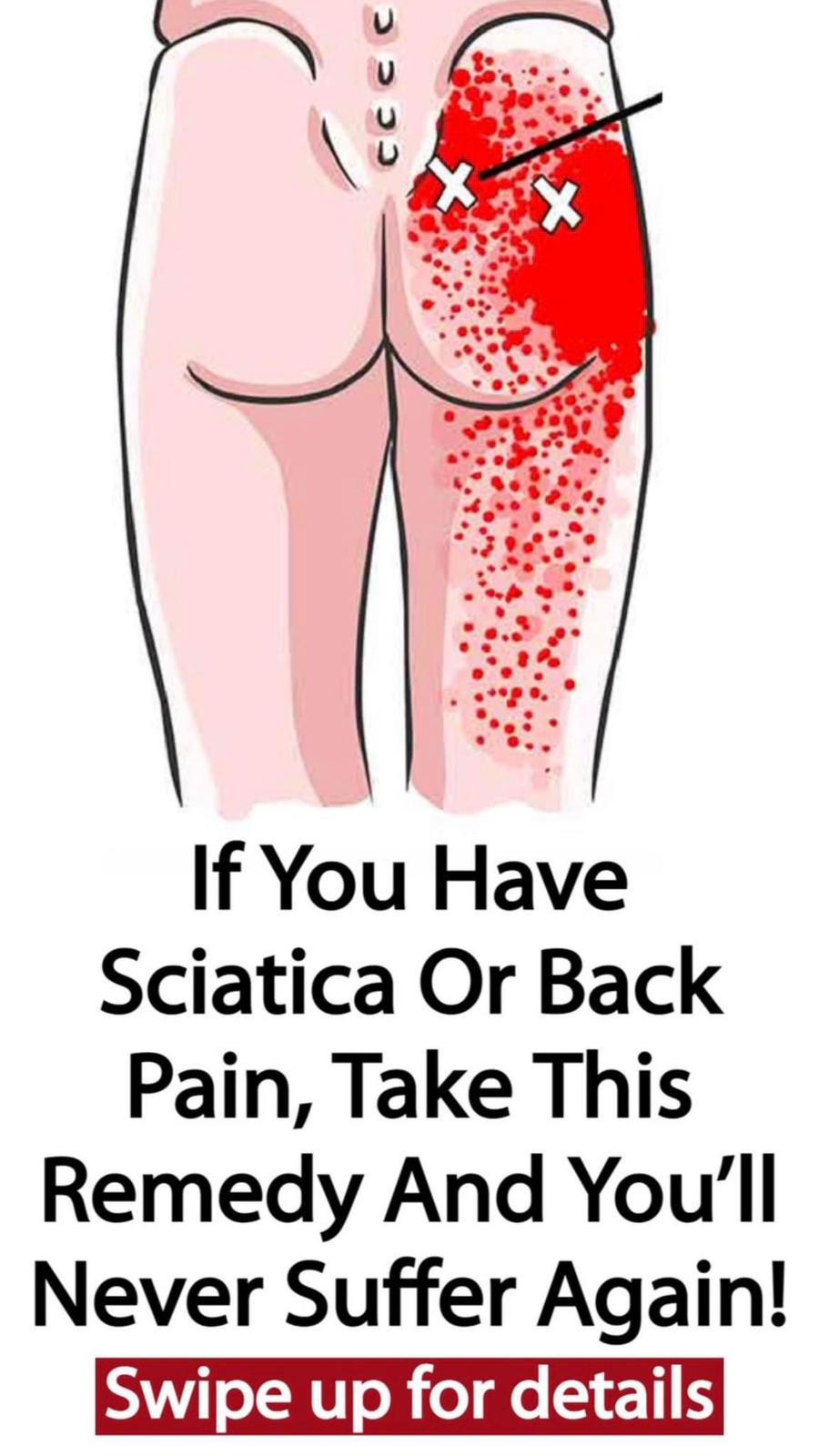 How to To Get Rid Of Sciatica, Hip And Lower Back Pain