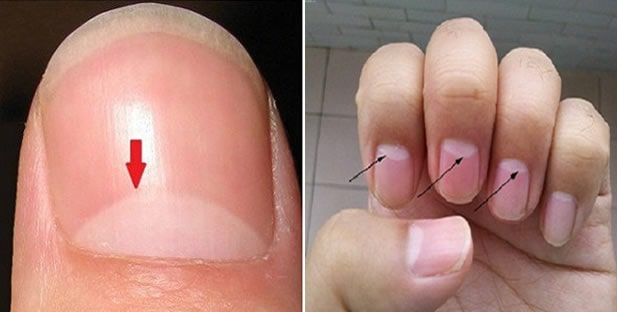 If You Have The Half Moon Shape On Your Nails, This Is What It Means.