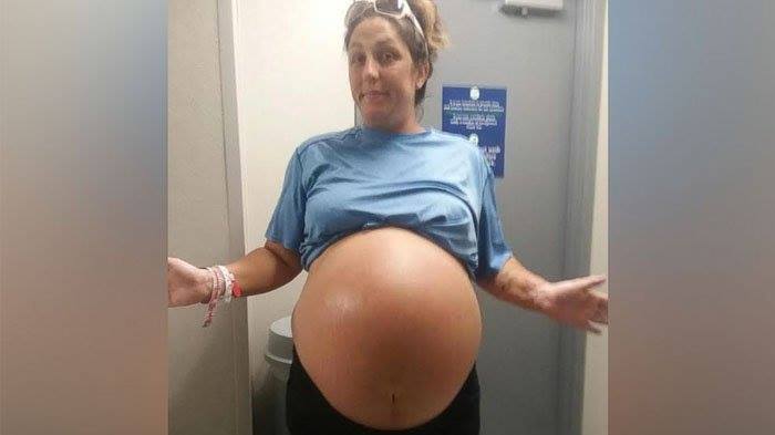 The mother who gave birth to a very big baby