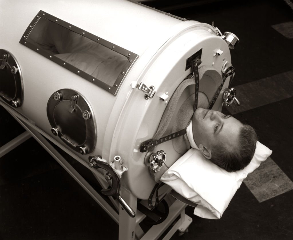 ‘My life is amazing:’ A 76-year-old man who was paralyzed by polio at the age of six is one of the last people with an iron lung.