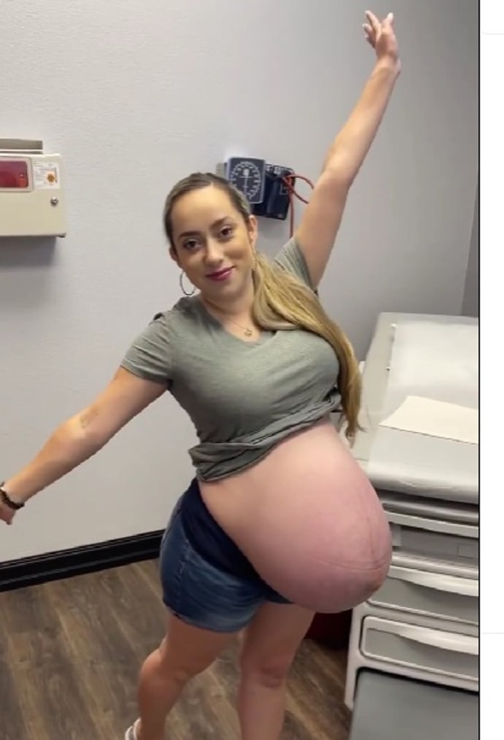 Harsh Remarks About Her Huge Belly Included “This Is The Worst Pregnant Belly I’ve Ever Seen”