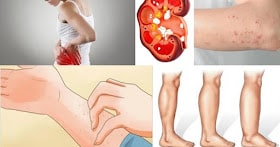 If Your Kidney Is in Danger, the Body Will Give You These 8 Signs!