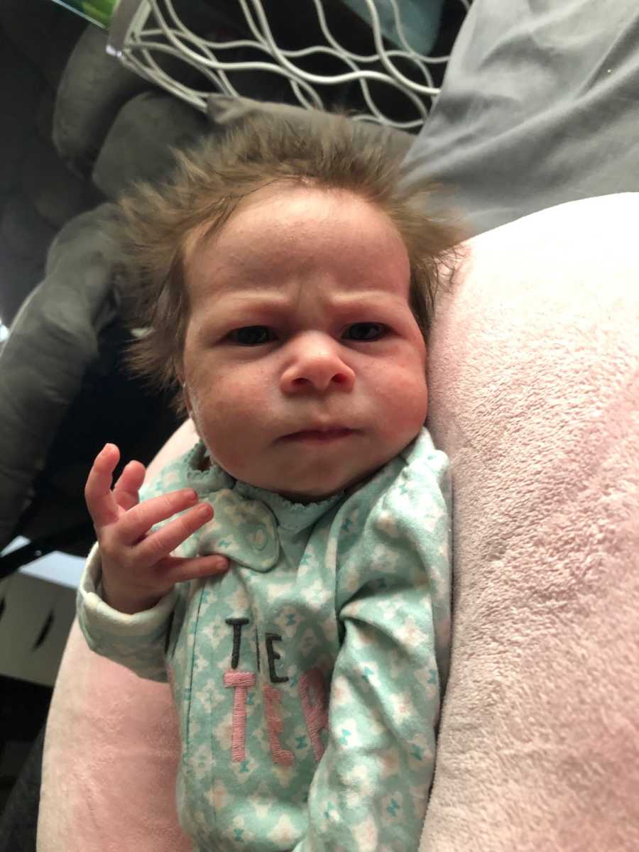 Baby born with an “angry” face and get Oligohydramnios diagnosis