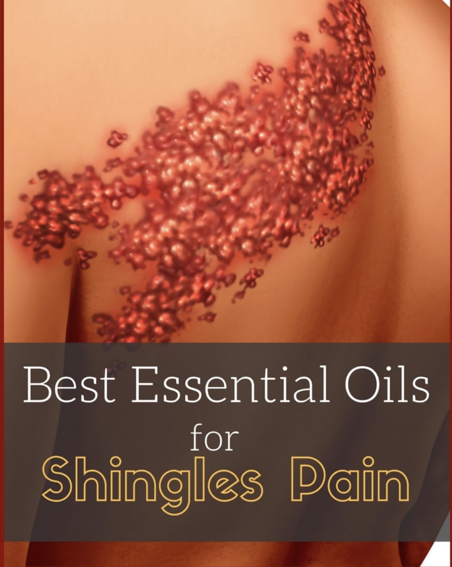 9 Best Essential Oils for Shingles Pain