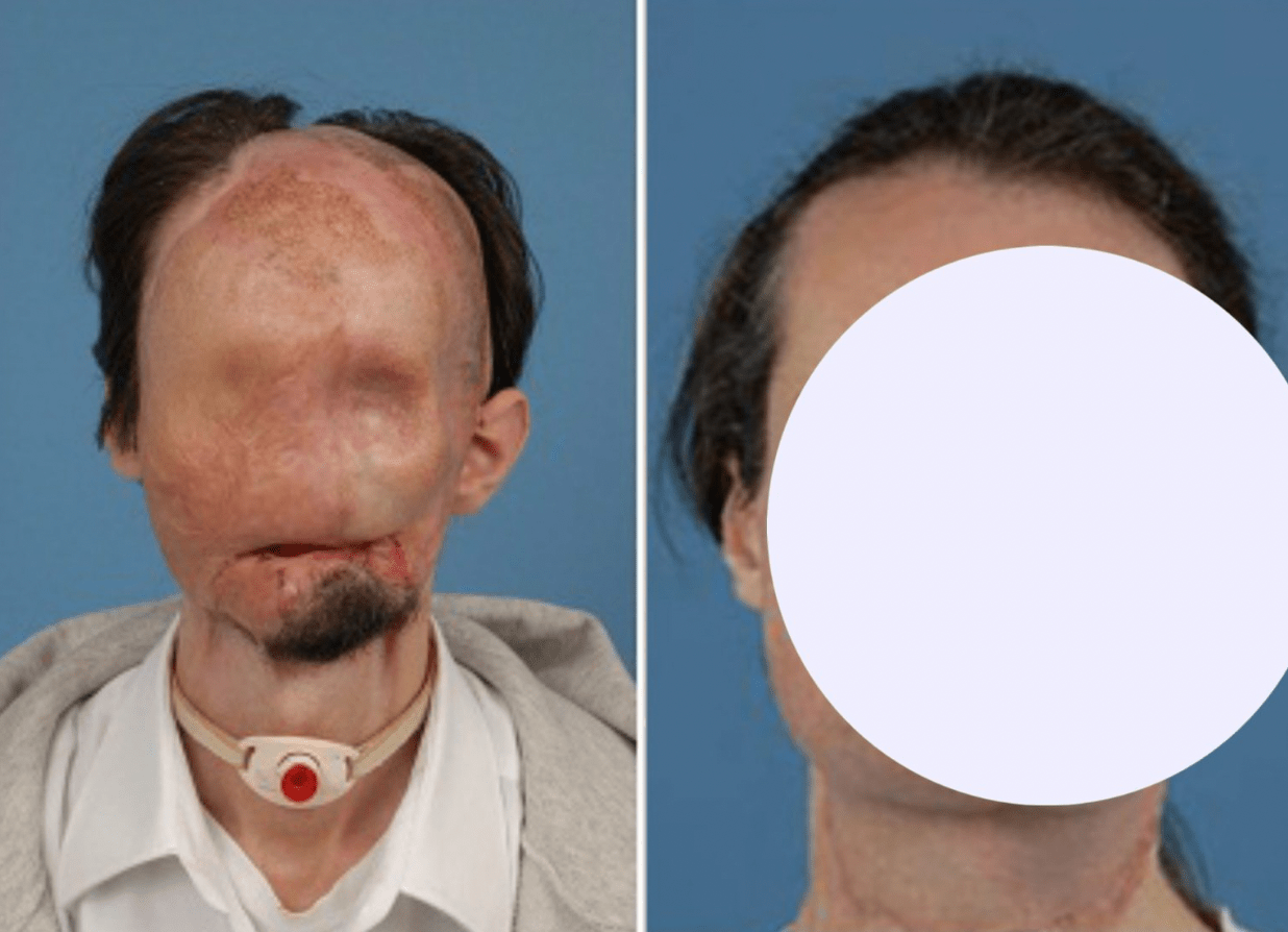 This transformation is incredible… See the result after surgery below…