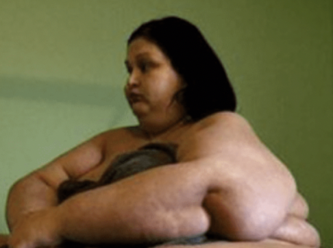 This woman used to weigh 500 kilos; however, she is 91 kilos now… Here is how she looks!