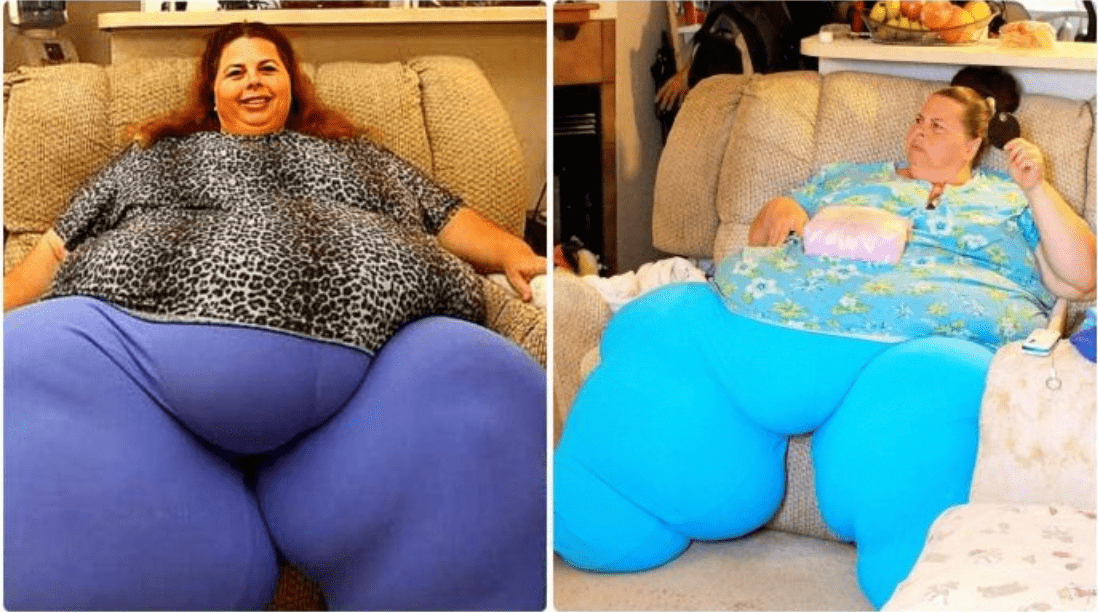 What a bold move! What kind of shape is the 57-year-old lady who dropped 518 pounds in her body in at this point?