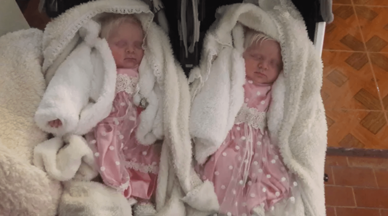 Mom Gives Birth to Rare Albino Twins With Snow-White Hair