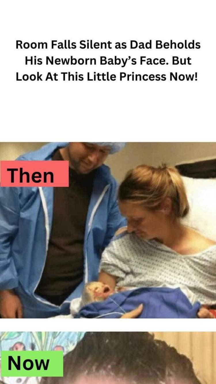 Urgent C-Section Done by Doctors: Room Falls Silent as Dad Beholds Baby’s Face