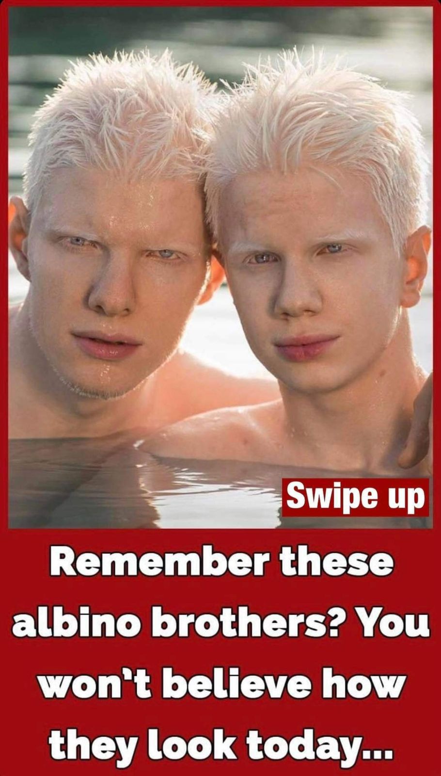 Bera and Tsotne Ivanishvili were born with albinism and their pictures are going viral because of their special looks