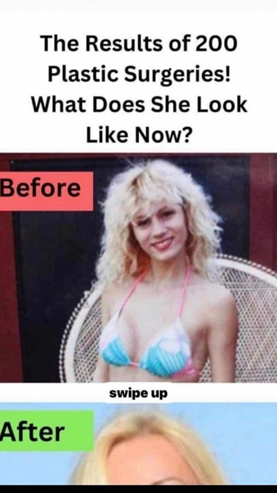 The Amazing Result of 200 Plastic Surgery Procedures