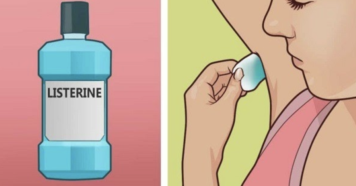 She Poured LISTERINE in a Cotton, and Rubs in Her UNDERARM. Minutes LATER, watch WHAT HAPPENS!!