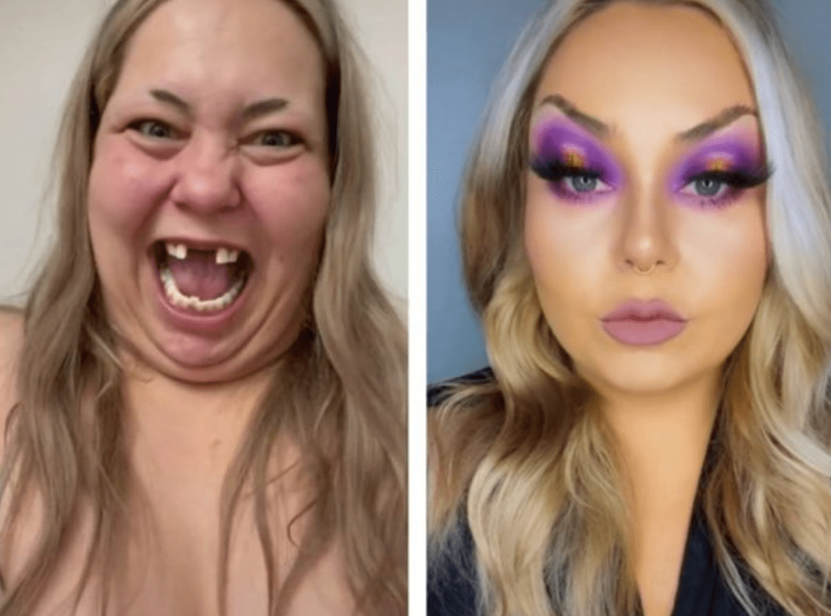 It’s difficult to believe that this blogger, who was previously missing teeth, has now magically changed into a princess…