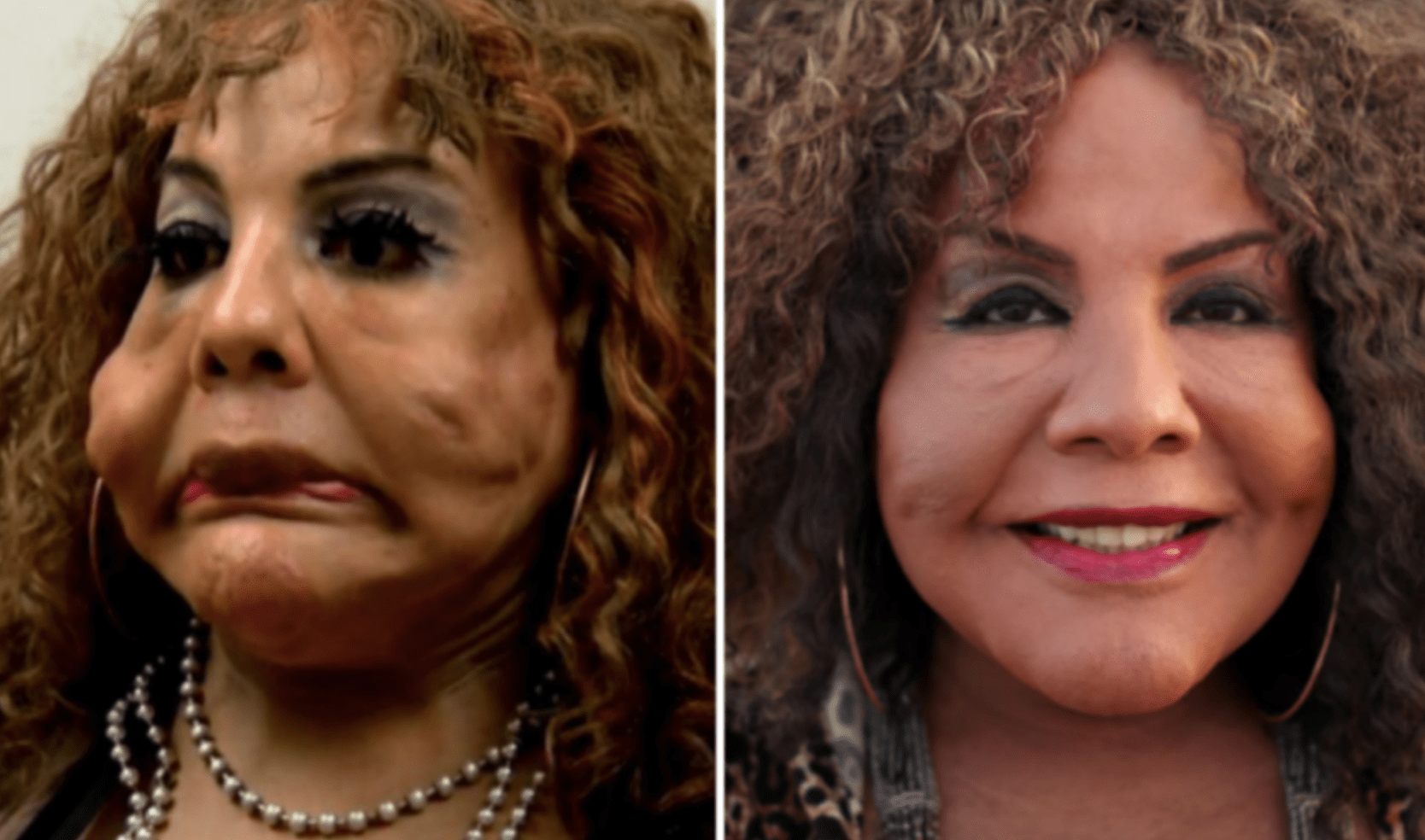 The most astonishing examples of “Botched” plastic surgery transformations…