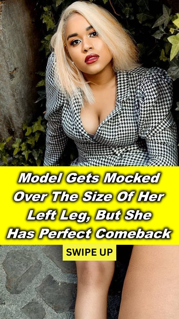 Model Gets Mocked Over Her Left Leg, Has Perfect Comeback