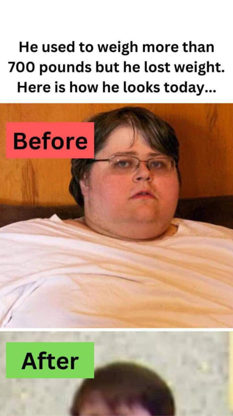 This man used to weigh more than 700 pounds but he lost weight and here is how he looks today…