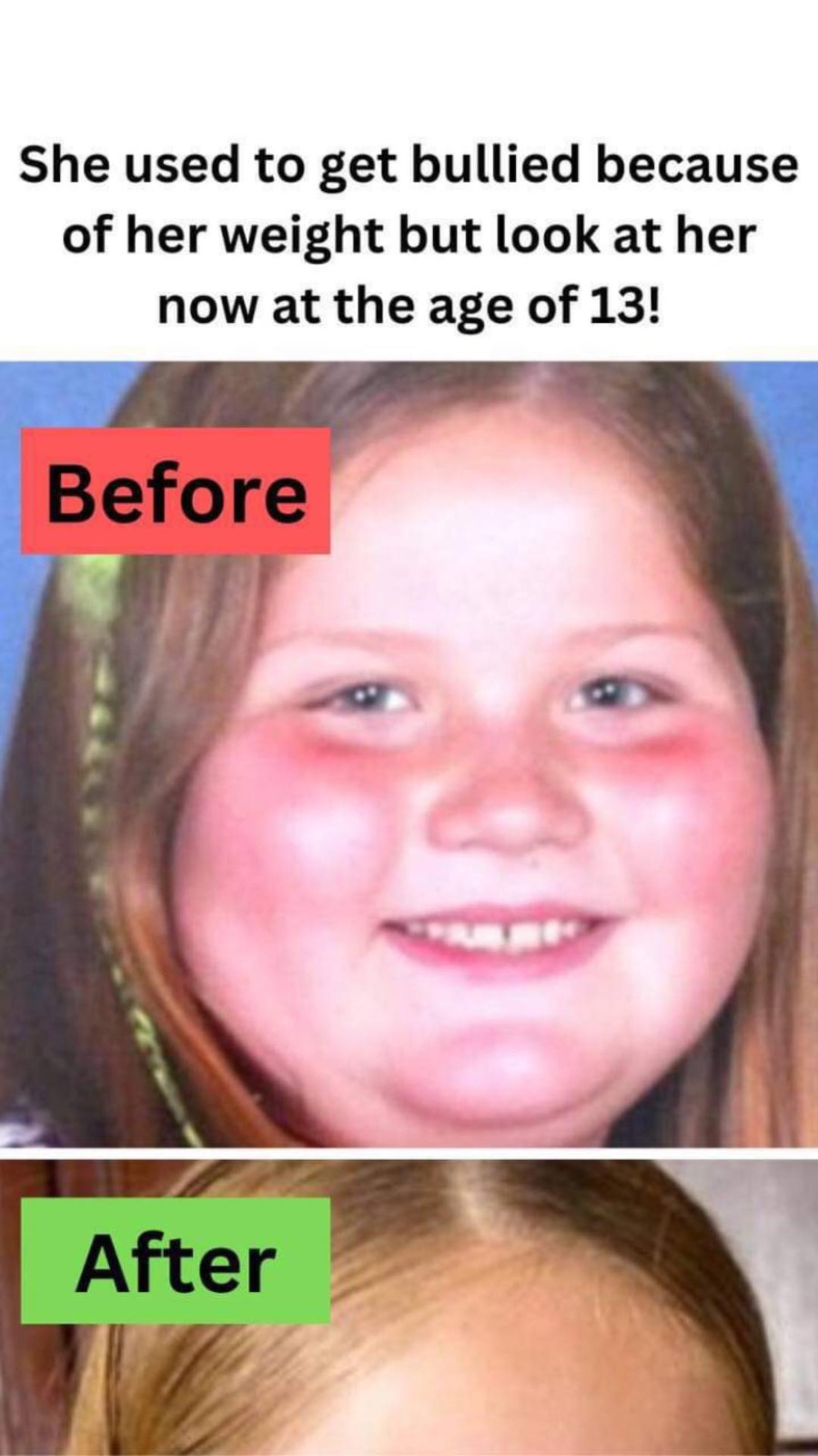 She used to get bullied because of her weight but look at her now at the age of 13!