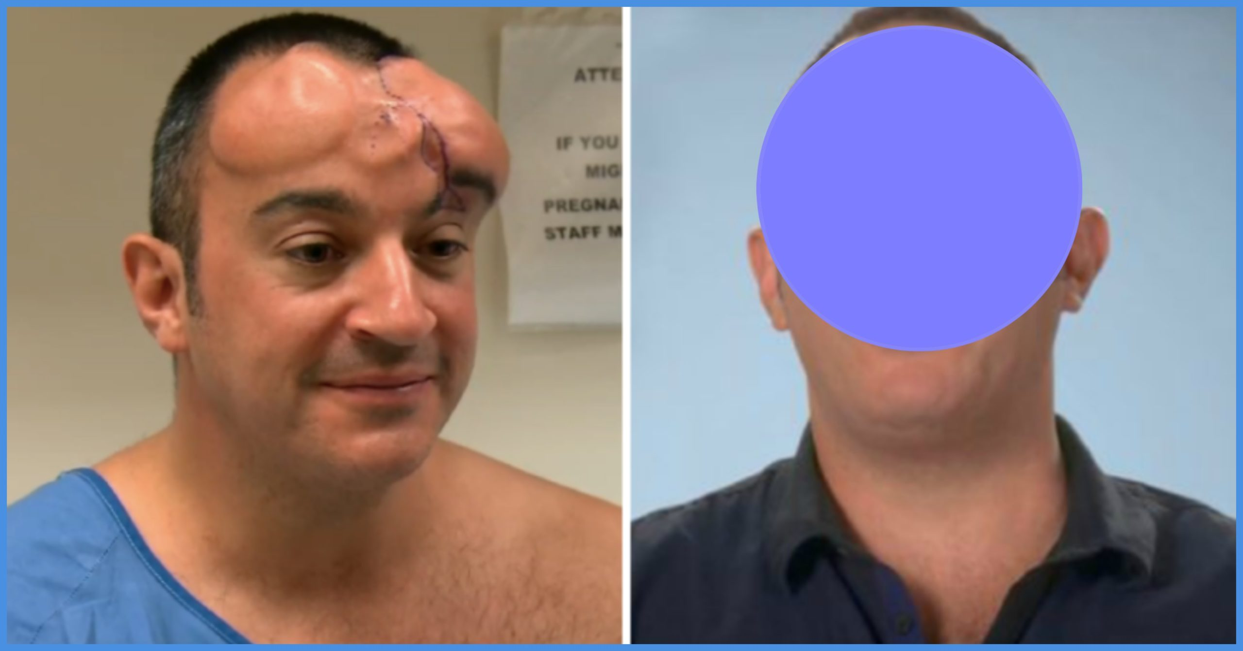 The most astonishing examples of “Botched” plastic surgery transformations…