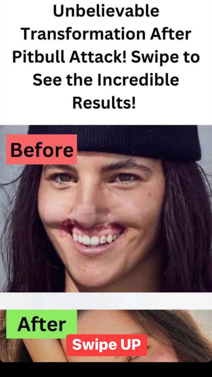 Pitbull attack survivor’s incredible facial transformation through plastic surgery! Tap here for catpivating ‘after’ photos!