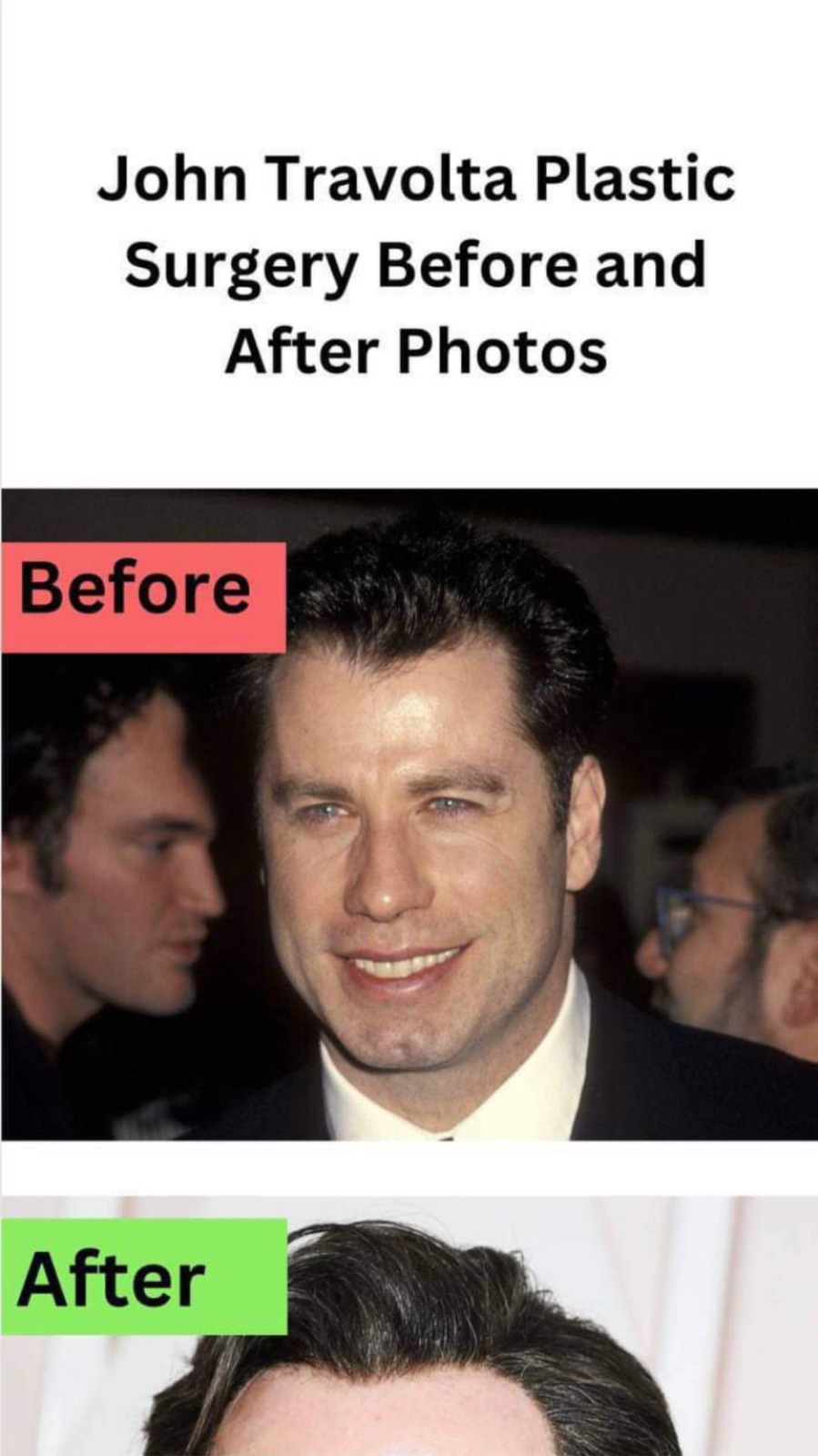 John Travolta’s Changing Appearance: A Journey through Plastic Surgery Speculations