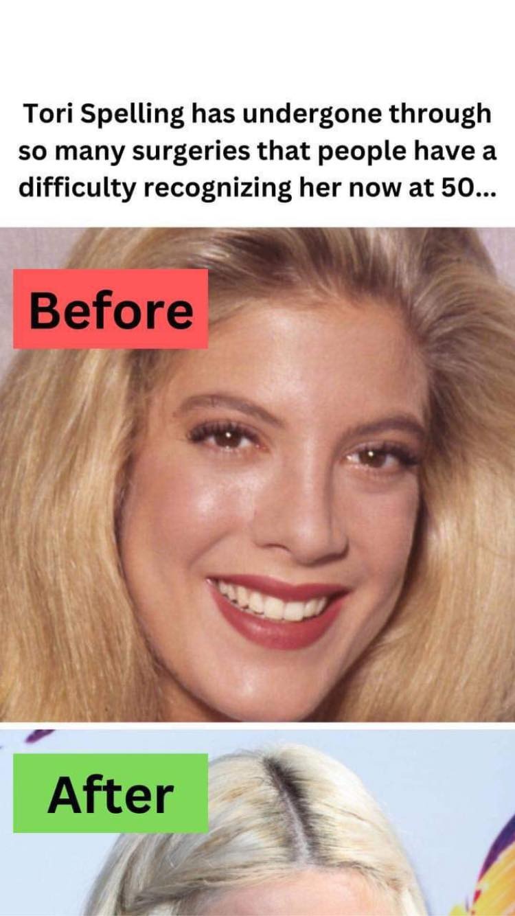 Tori Spelling has undergone through so many surgeries that people have a difficulty recognizing her now at 50…