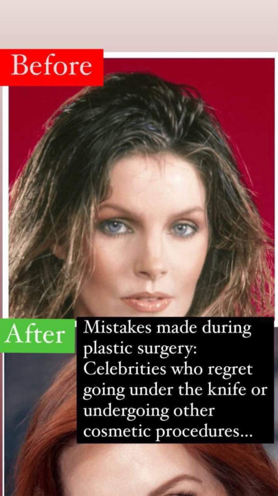 Mistakes made during plastic surgery: Celebrities who regret going under the knife or undergoing other cosmetic procedures…