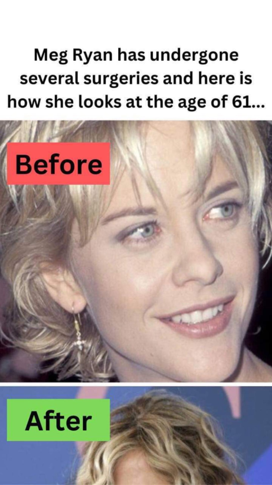 Meg Ryan has undergone several surgeries and here is how she looks at the age of 61…