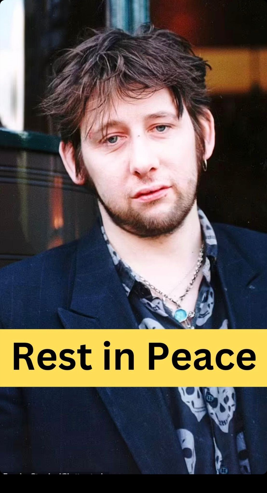 Rest In Peace, Popular Hard-Living Irish Punk Genius has Passed Away