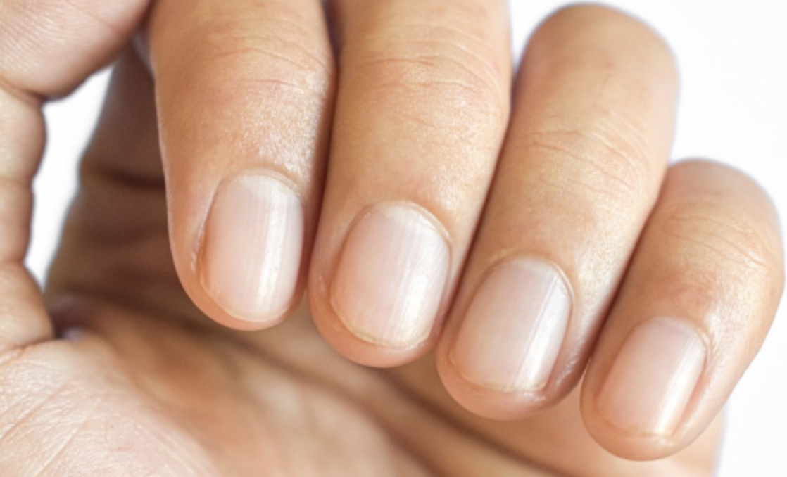 Discover the Meaning Behind the Unusual Crescent Shape on Your Nail