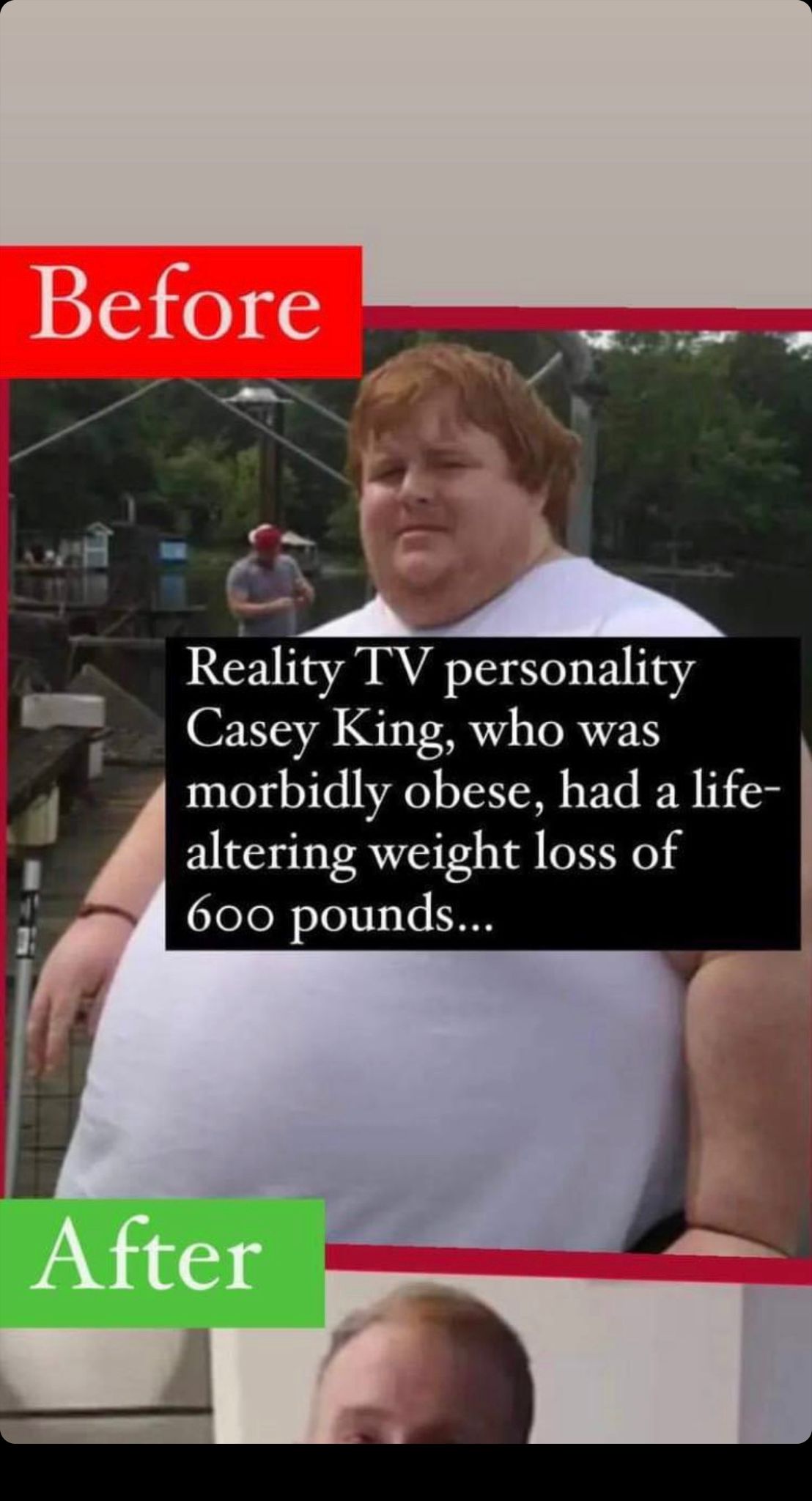 Reality TV personality Casey King, who was morbidly obese, had a life-altering weight loss of 600 pounds…