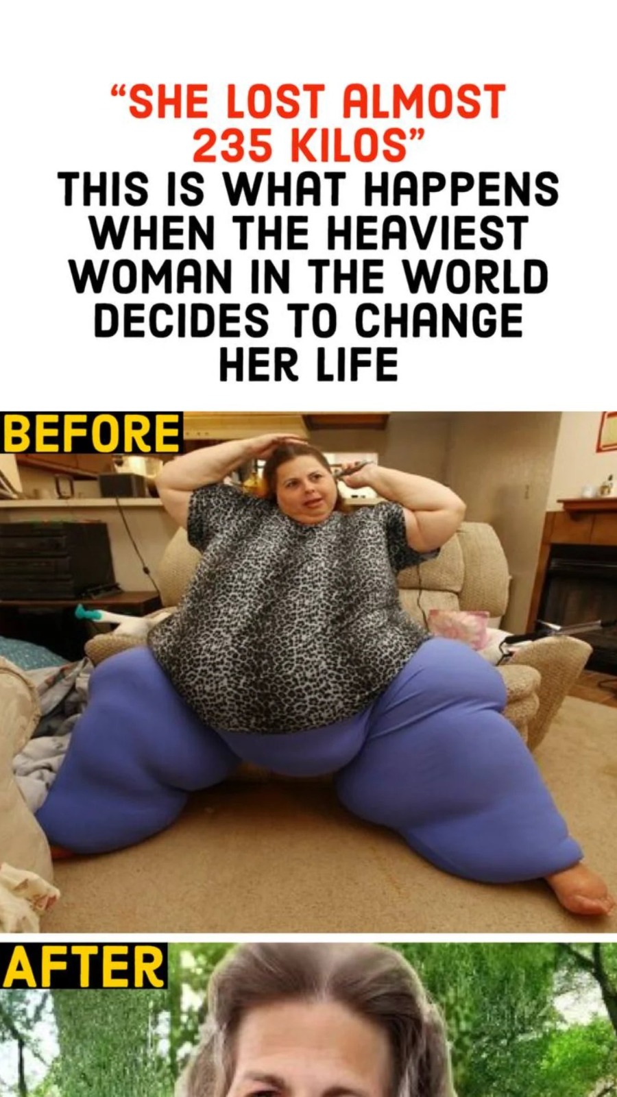 “She lost almost 235 kilos”. This is what happens when the heaviest woman in the world decides to change her life