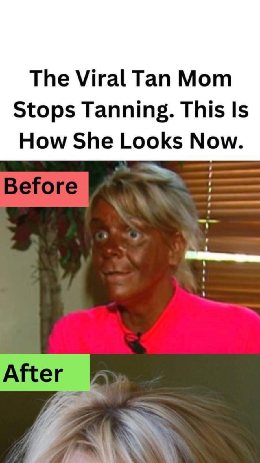 The Tan Mom’s Dramatic Transformation: From Tanning Obsession to Life on the Brink