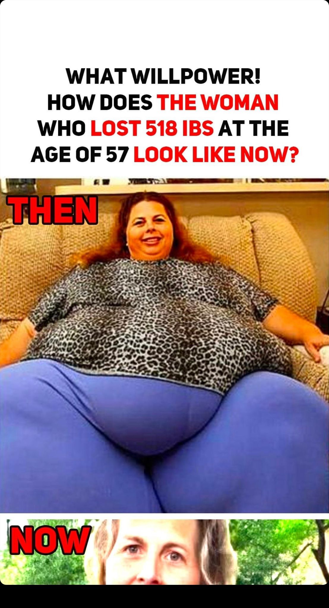 What Strength! What Does the 57-year-old woman who lost 518 pounds Look Like Now?