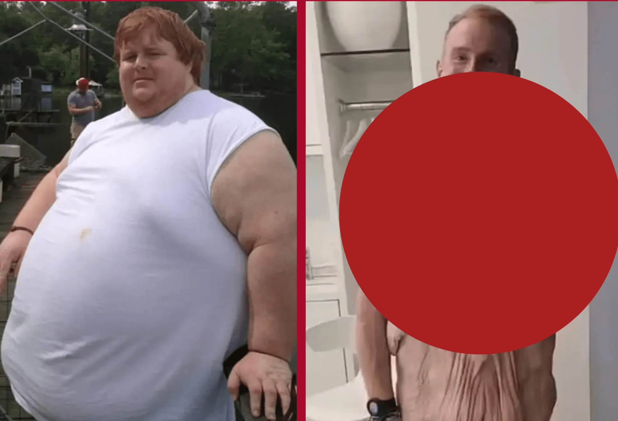 Reality TV personality Casey King, who was morbidly obese, had a life-altering weight loss of 600 pounds…