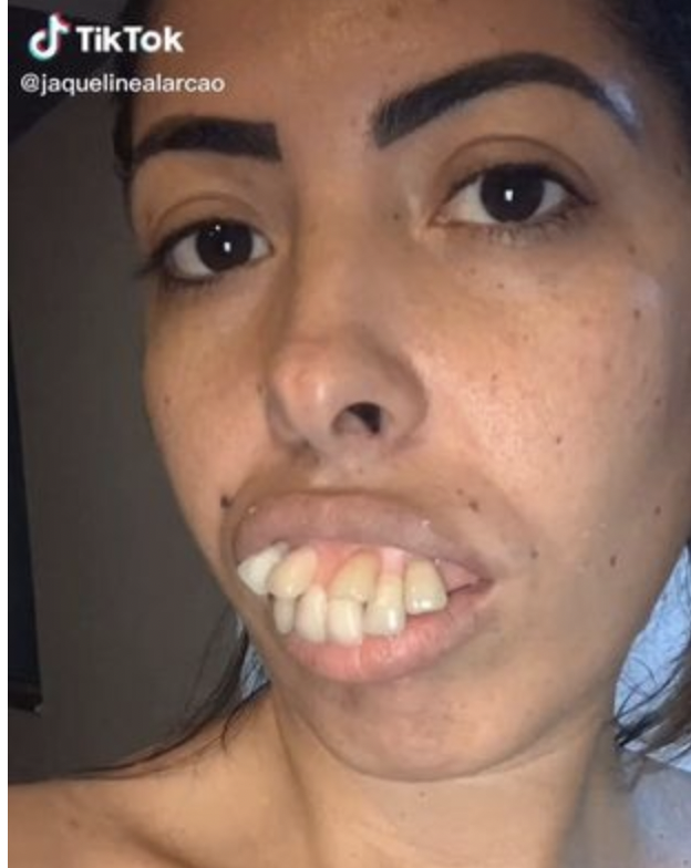 Millions of people see a woman’s dental “transformation,” yet some notice a problem…