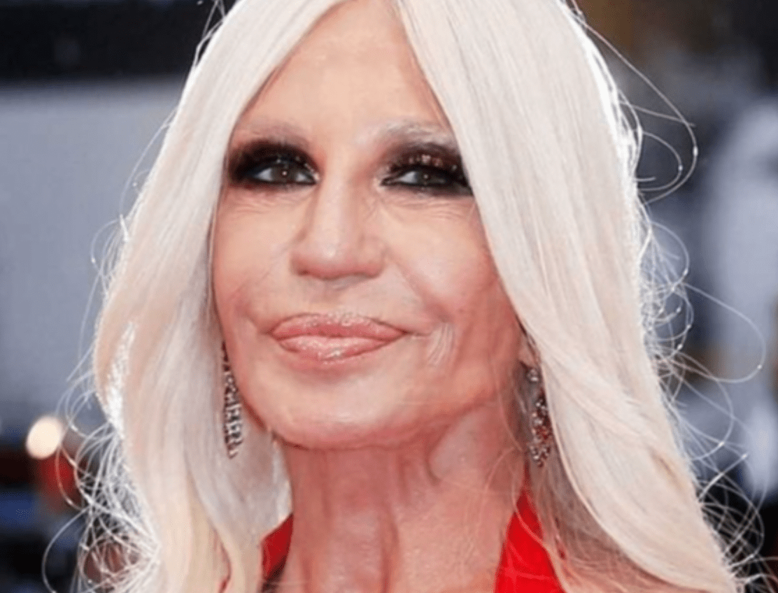 How did Donatella Versace Look Before Her Multiple Plastic Surgery Procedures?