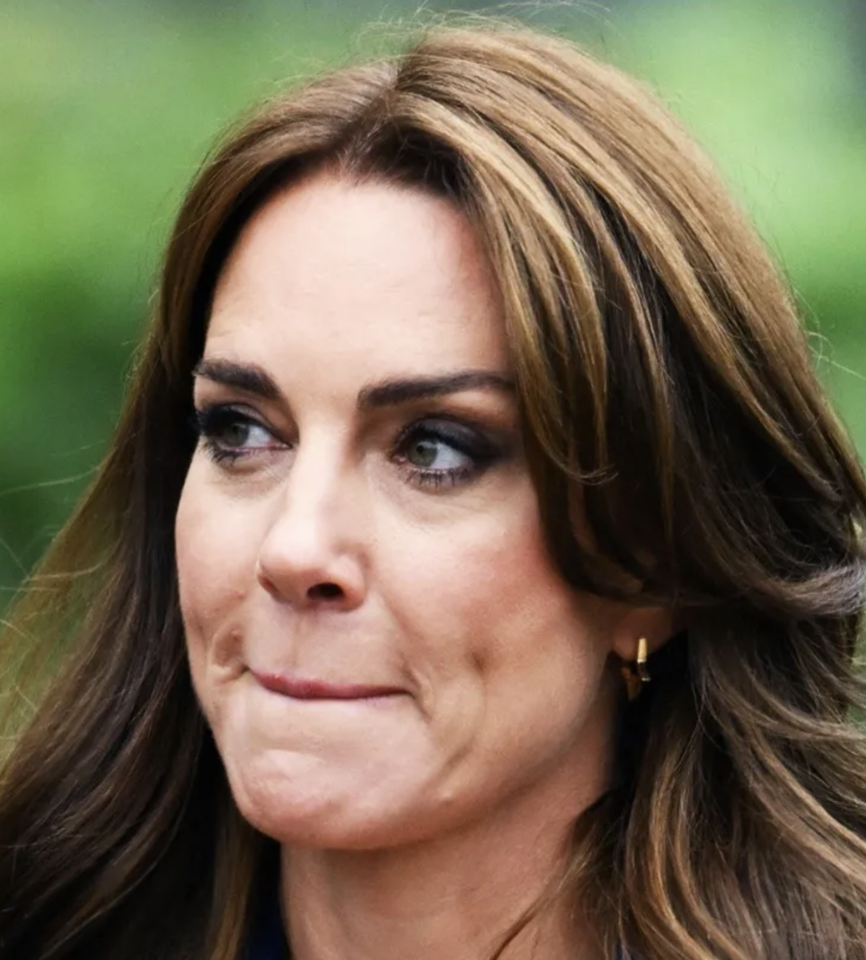 Kate Middleton’s abdominal surgery recovery could take nine months, doctor claims