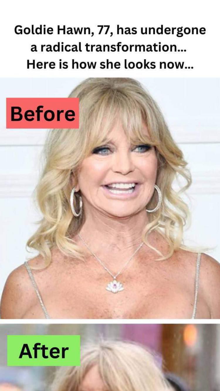 Goldie Hawn, 77, has undergone a radical transformation… Here is how she looks with new facial expressions and a smirky appearance…