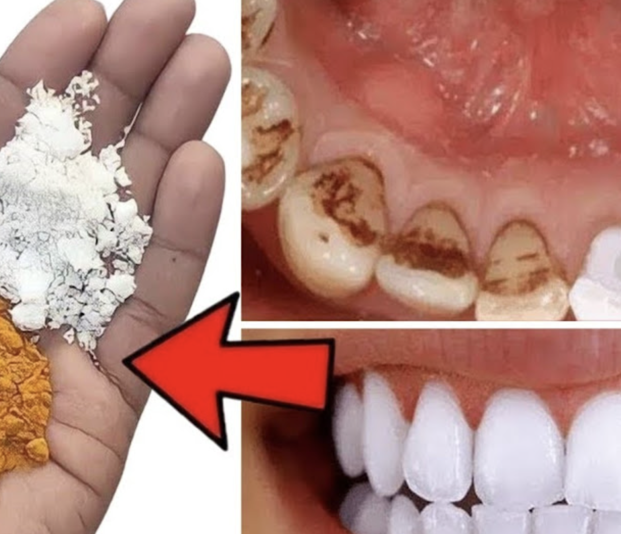 The Quick At-Home Teeth Whitening Secret