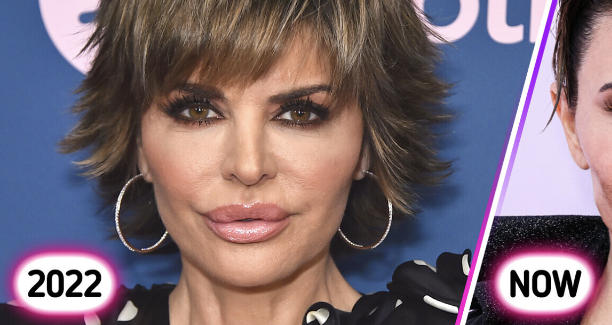 «What Did She Do to Her Face?», Lisa Rinna’s Latest Appearance Sparks Controversy