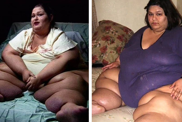 “Life after losing weight.” What the woman, who was deperate about her shape, looks like now