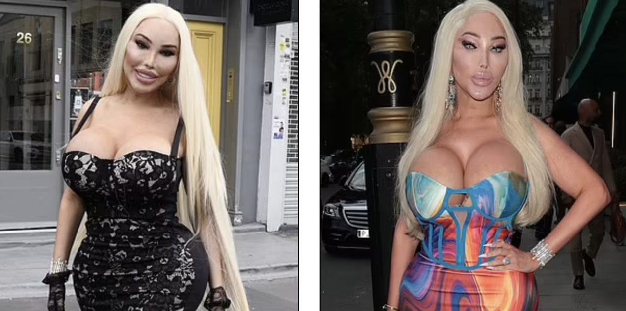 Real-Life Barbie Shows Off Her Latest Transformation