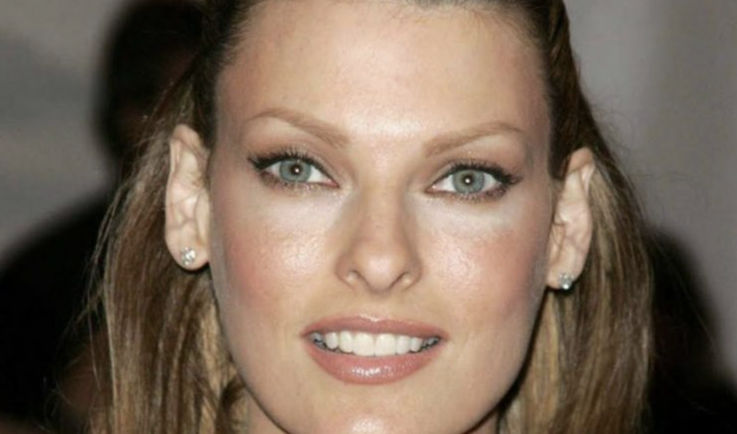 Linda Evangelista, facing depression and disappointment, appeared before cameras post a plastic surgery gone wrong…