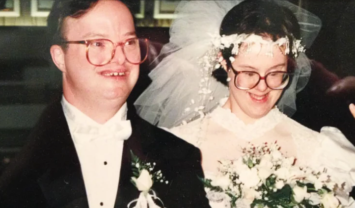 Everyone was against this couple’s relationship because they had Down Syndrome but check out how they look together after 25 years…