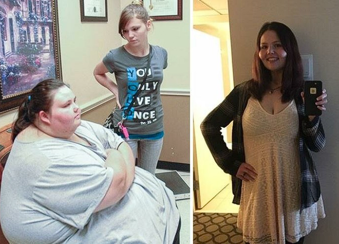 “Minus 550 Pounds In 2 Years”: A Girl Managed To Change Her Life From a Plump Girl To a Cute Beauty!